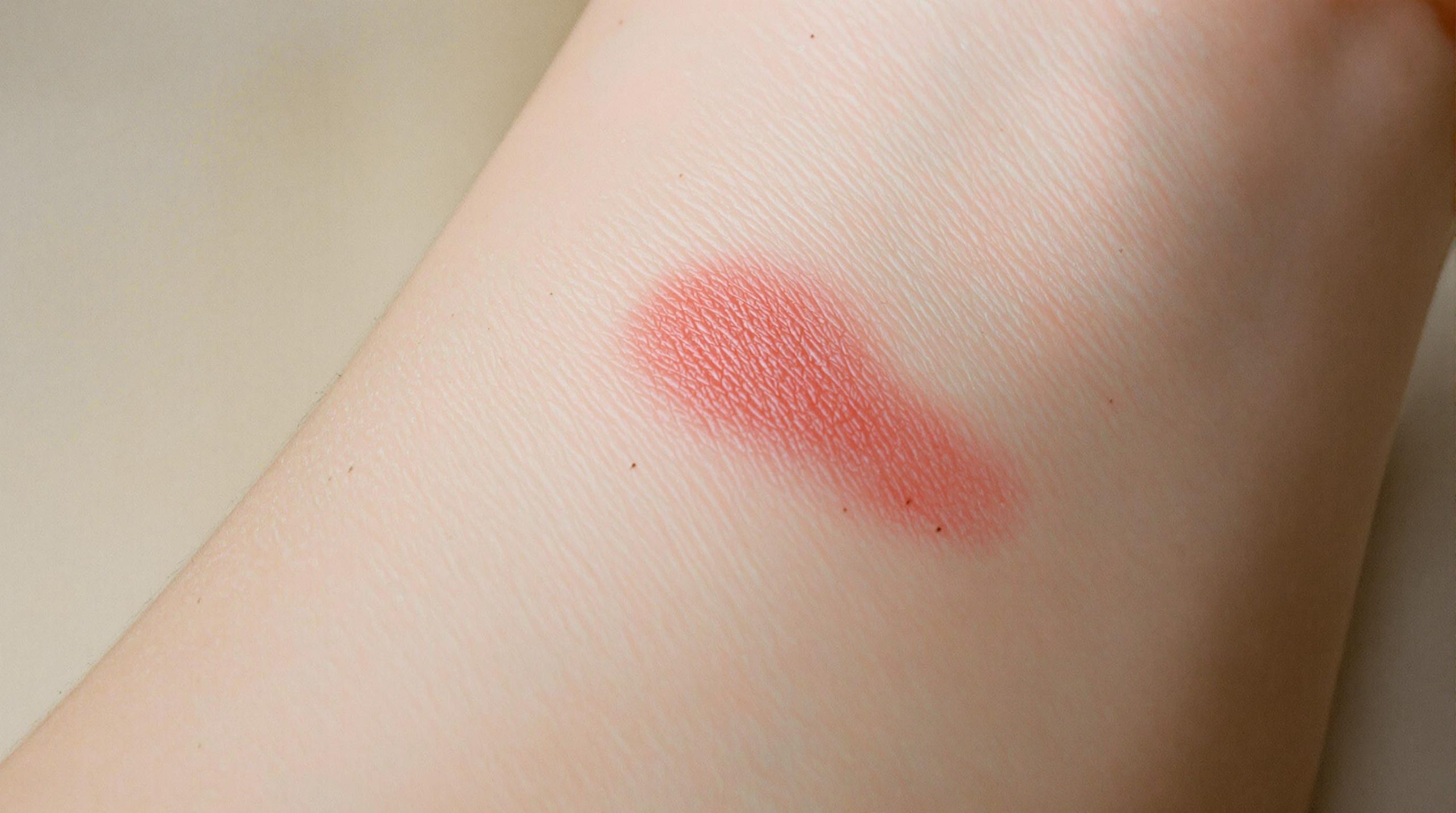 Cicatrice rouge : que faire ? - Beaute Serenite