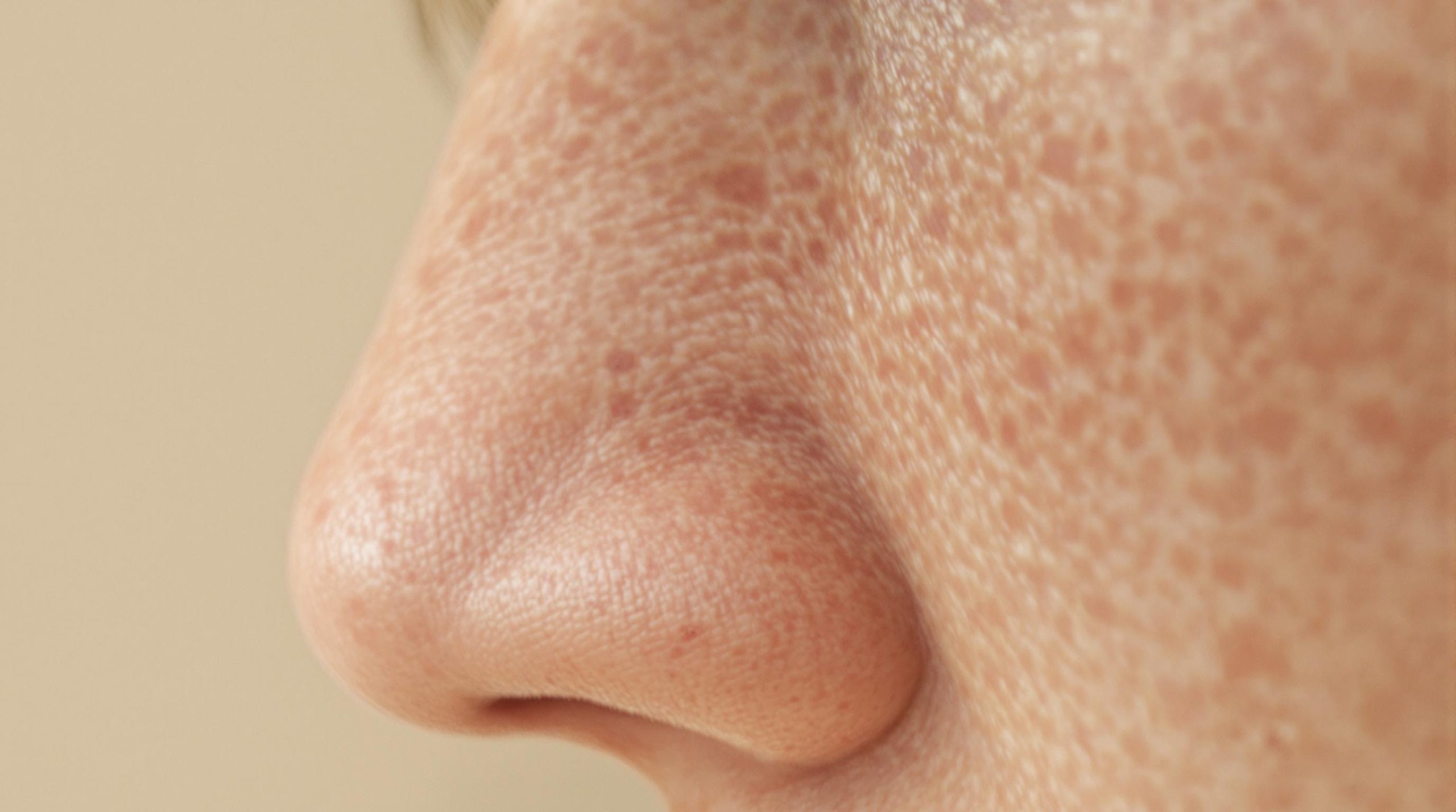 Comprendre et améliorer la peau texturée - Beaute Serenite